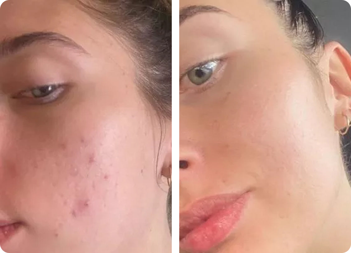 Elena U: Pēc 3 nedēļām