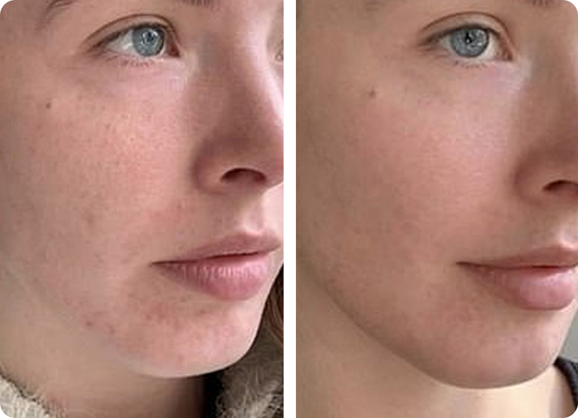 Elžbieta J: Pēc 3 nedēļām